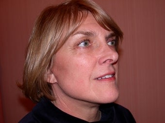 Facelift, Neck lift, Blepharoplasty
