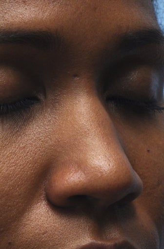 Non-Surgical Nose Job