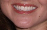 Full Lip