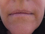 Lips 