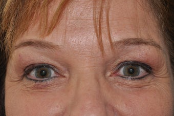 Permanent Eyeliner