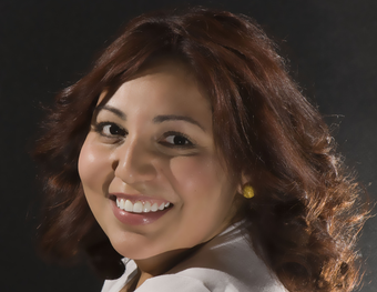 porcelain veneers