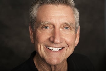 Upper and Lower Veneers