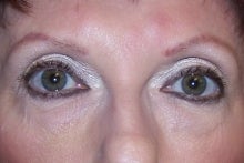 Prevelle Silk Under the Eyes