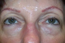 Prevelle Silk Under the Eyes