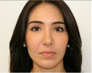 Facial Rejuvenation with Soft tissue fillers