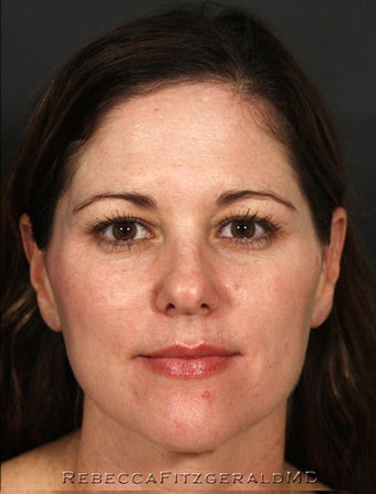 Restylane, Botox, Obagi Skin Care