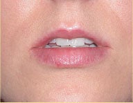 Injectables 