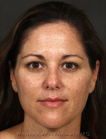 Restylane, Botox, Obagi Skin Care