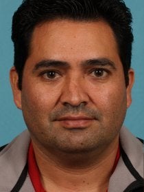 Male Revision Rhinoplasty