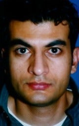 Rhinoplasty