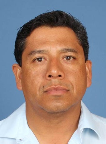 Rhinoplasty, Nasal Fracture Repair