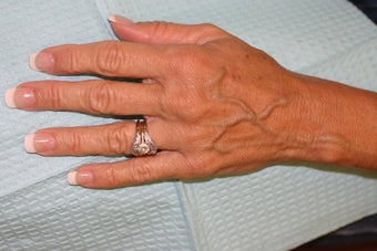 Hands