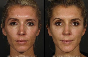 Restylane, Sculptra, Dysport, Obagi Professional C Serum, Cosmelan, Latisse