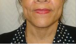 Laser Liposuction