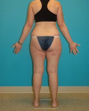 Midlife make-over