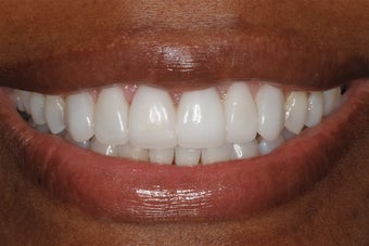 Cosmetic Dentistry