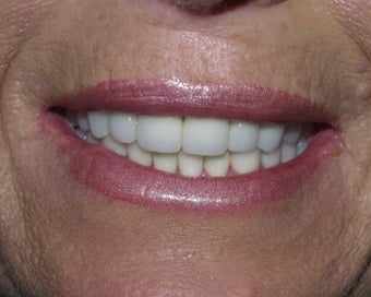 Sedation Dentistry