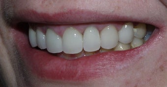 Sedation Dentistry