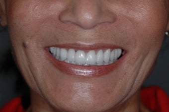 Smilemaker
