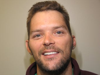 Smile Makeover