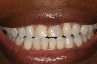 Cosmetic Dentistry