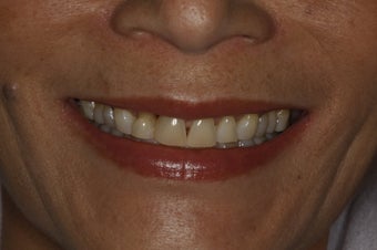 Smilemaker