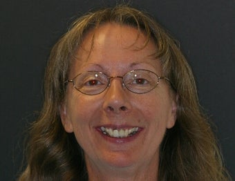 Smile Makeover