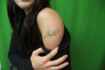 Laser Tattoo Removal