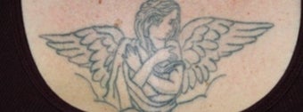 Laser tattoo removal