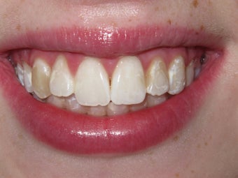 Kor Whitening