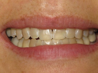 KOR Whitening