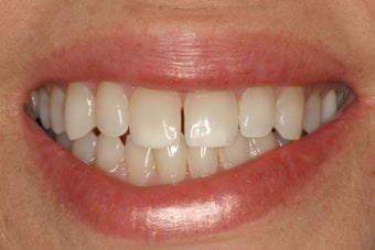 KOR Whitening