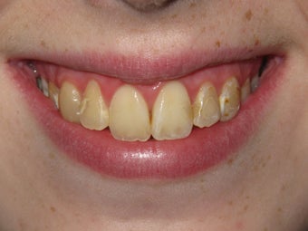 Kor Whitening