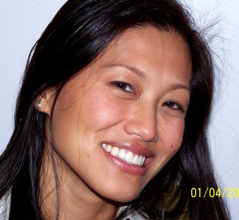 Porcelain Veneers