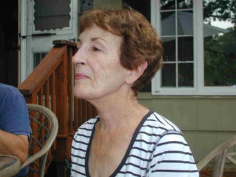 80 year old necklift