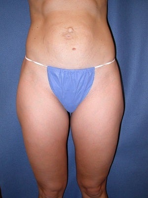 31 year old female, 5'7" 145 lbs.