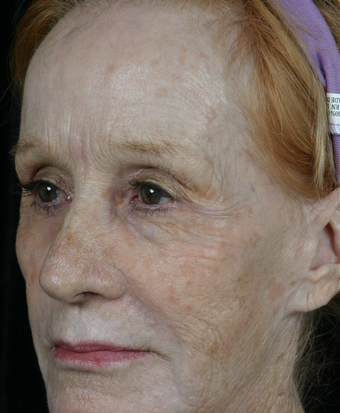 Pearl Fractional