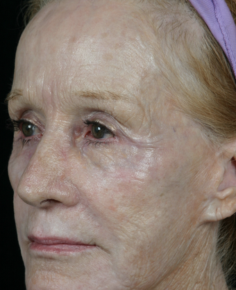 Pearl Fractional