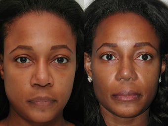 African American Female