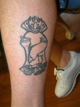 Tattoo Removal