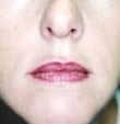 36 year old female patient 