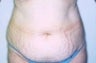 48 year old female patient 