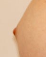 Before and After Nipple Reduction (Length)
