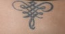 Unwanted tattoo in an adult
