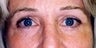 53 year old female patient 