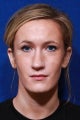 Rhinoplasty/Lip Augmentation