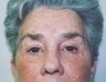 68 year old female patient 