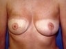 36 year old female patient 