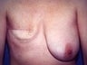 36 year old female patient 